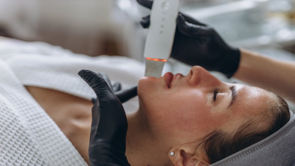 Microneedling in Barrie - Innisfil